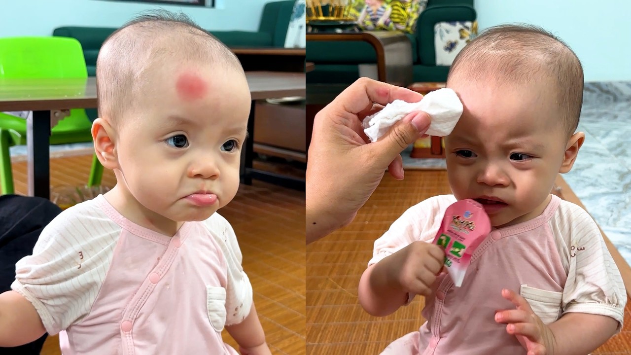 Kim's mother was worried when saw her forehead was red and swollen