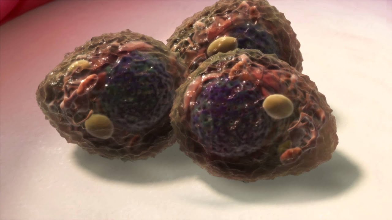 Genetic causes of myeloma