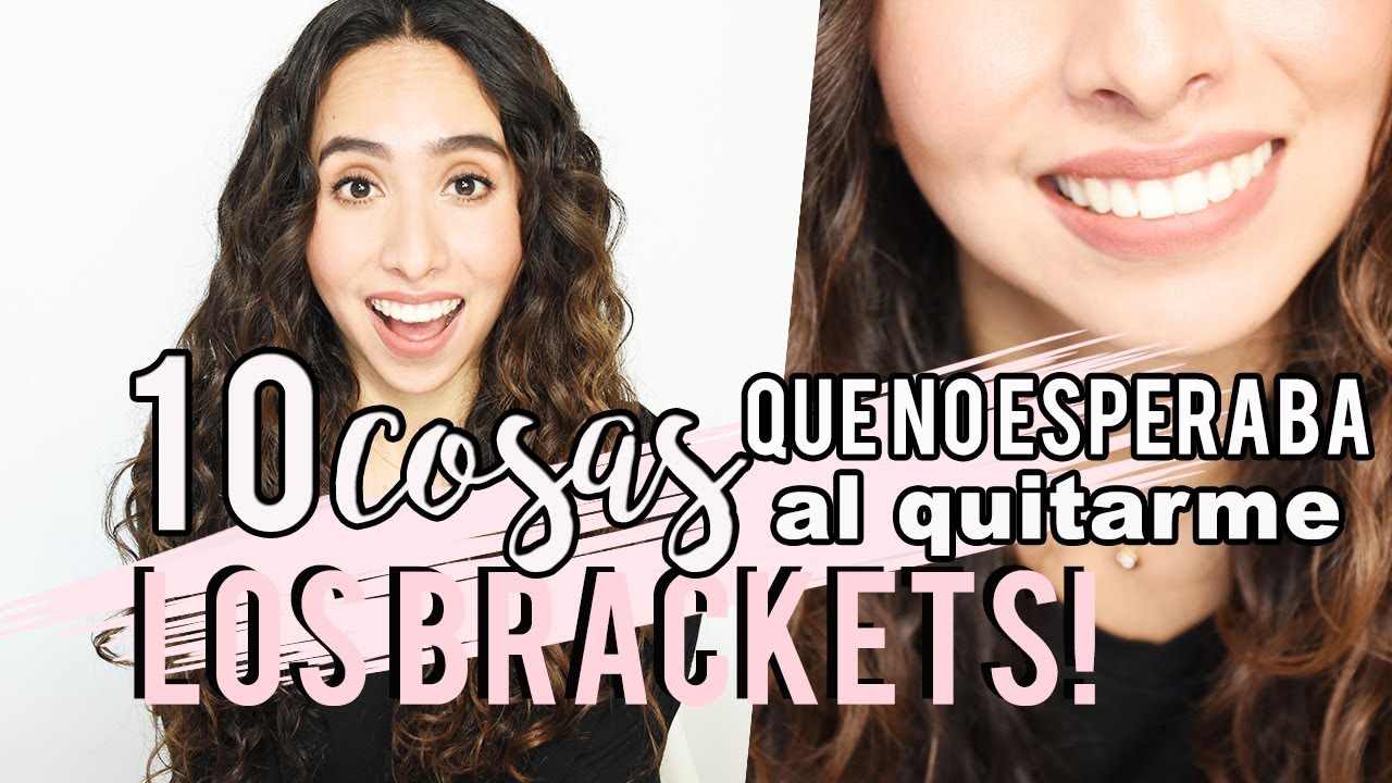 10 COSAS QUE NO ESPERABA AL QUITARME LOS BRACKETS! QUÉ PASA DESPUÉS?