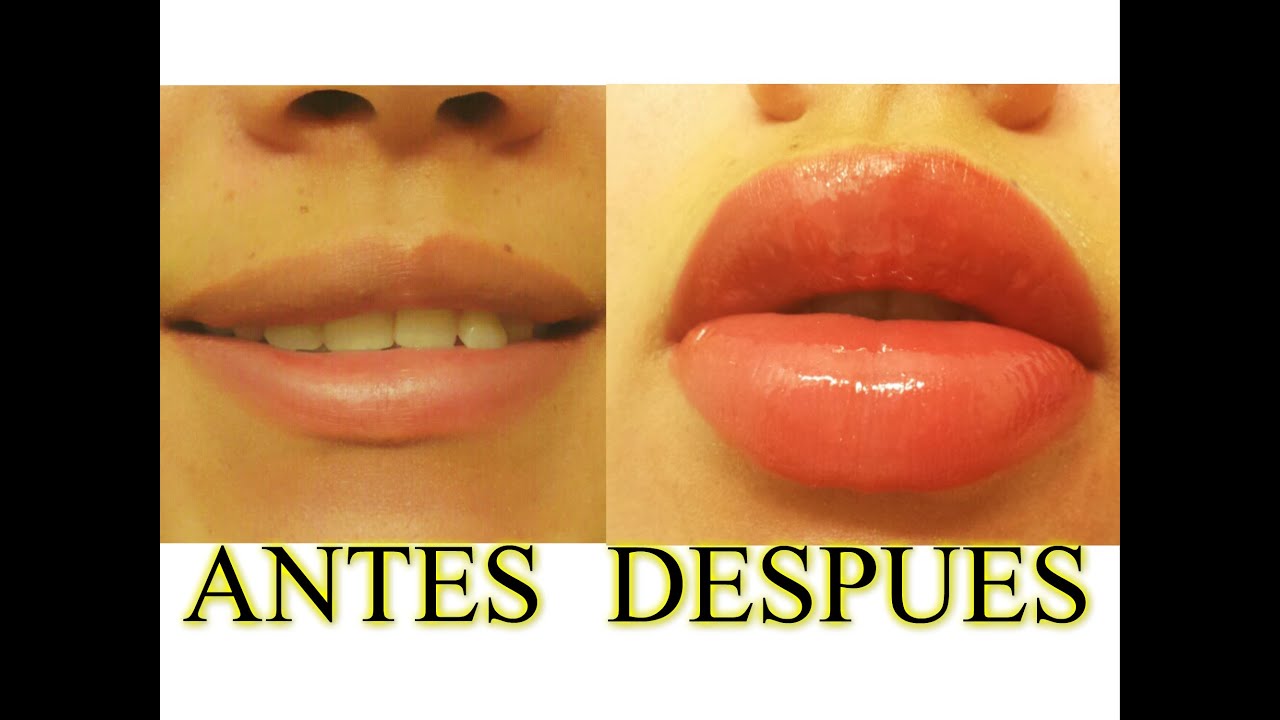 LABIOS MAS GRANDES! CON EXFOLIANTE CASERO | AANGIE