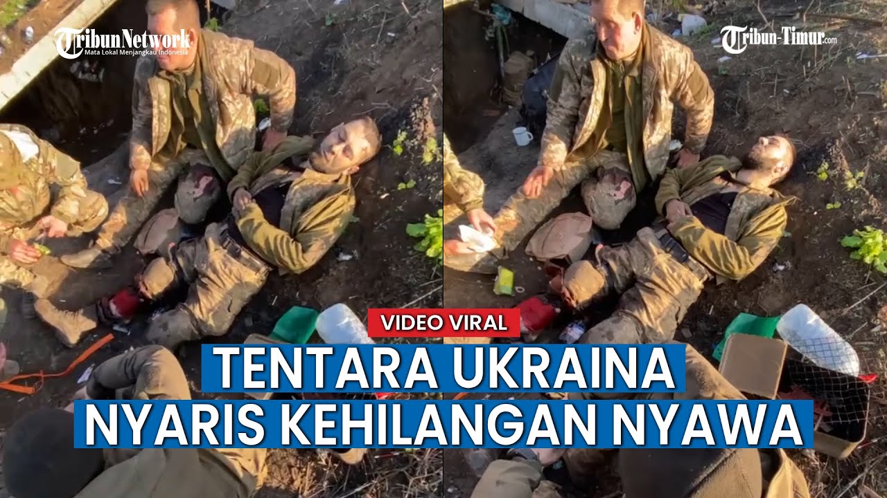 Nyaris Kehilangan Nyawa, Tentara Ukraina Terluka di Bagian Kaki