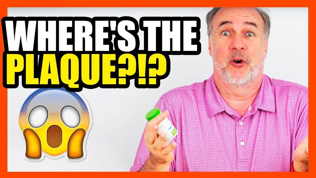 Where's the Plaque?- After Six Months of PRO-Dental Probiotics