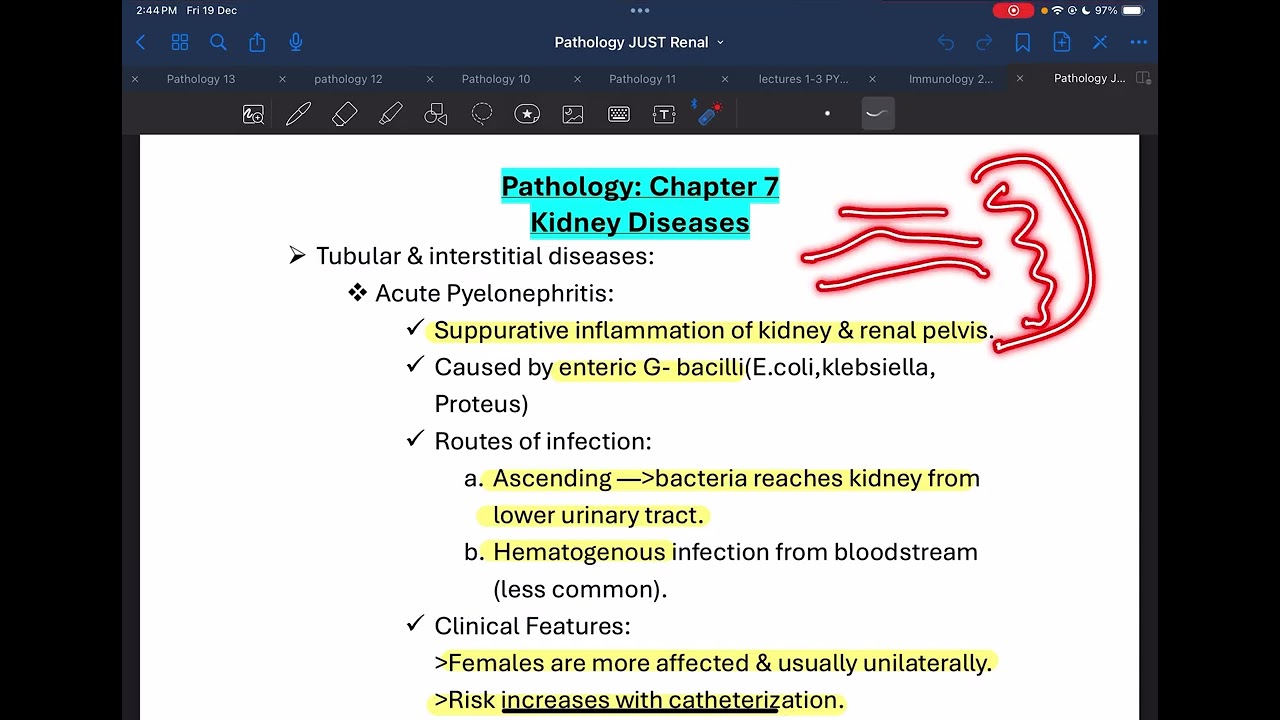 Chapter 7 JUST part 2