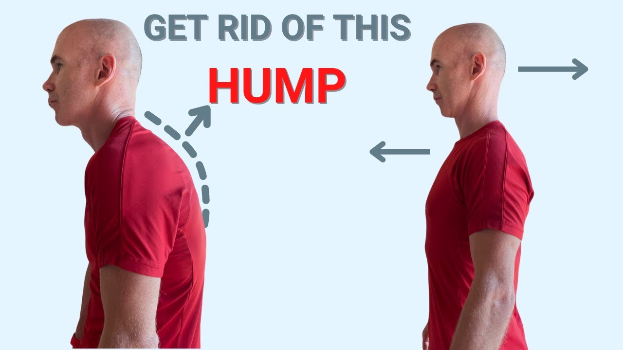 Stretching and Strengthening Exercises to Fix Dowager's Hump AKA Kyphosis | Ed Paget