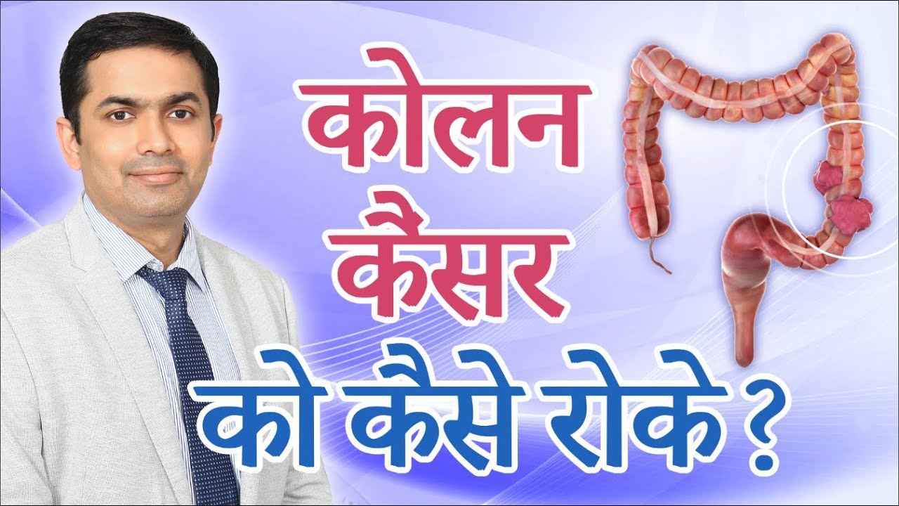 What is Colon Cancer? Know Causes, Symptoms, Diagnosis and Treatment for It.