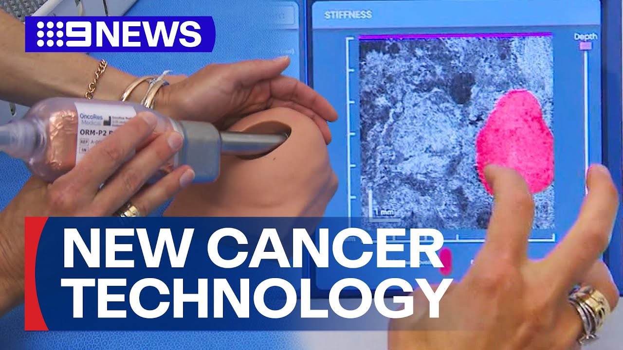 Cancer revolution technology underway in Australia | 9 News Australia