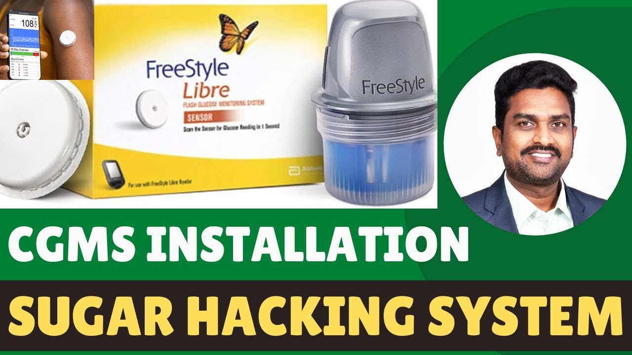 CGMS UNBOXING AND INSTALATION IN TELUGU