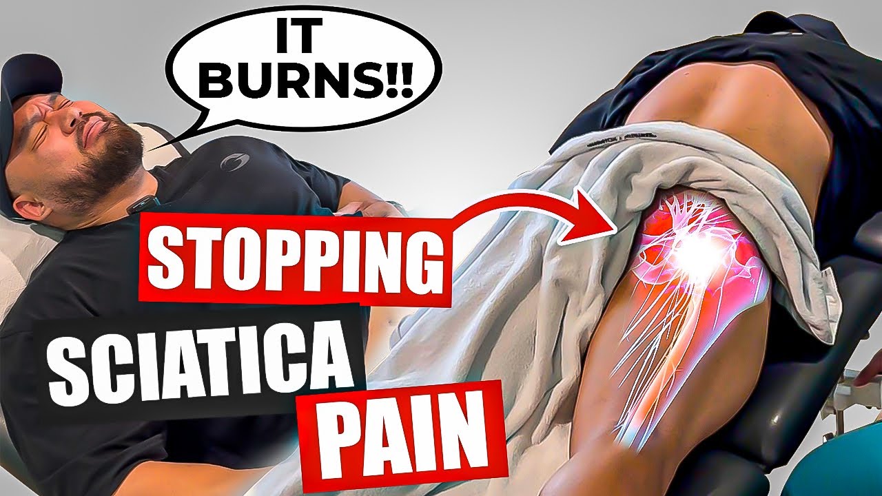 GAME-CHANGING Sciatica Treatment for INSTANT Sciatica Pain Relief - Dr Ranen Rambrij ( MUST WATCH )