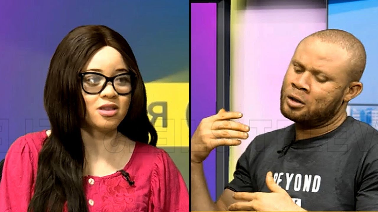 How To Live In Nigeria As An Albino