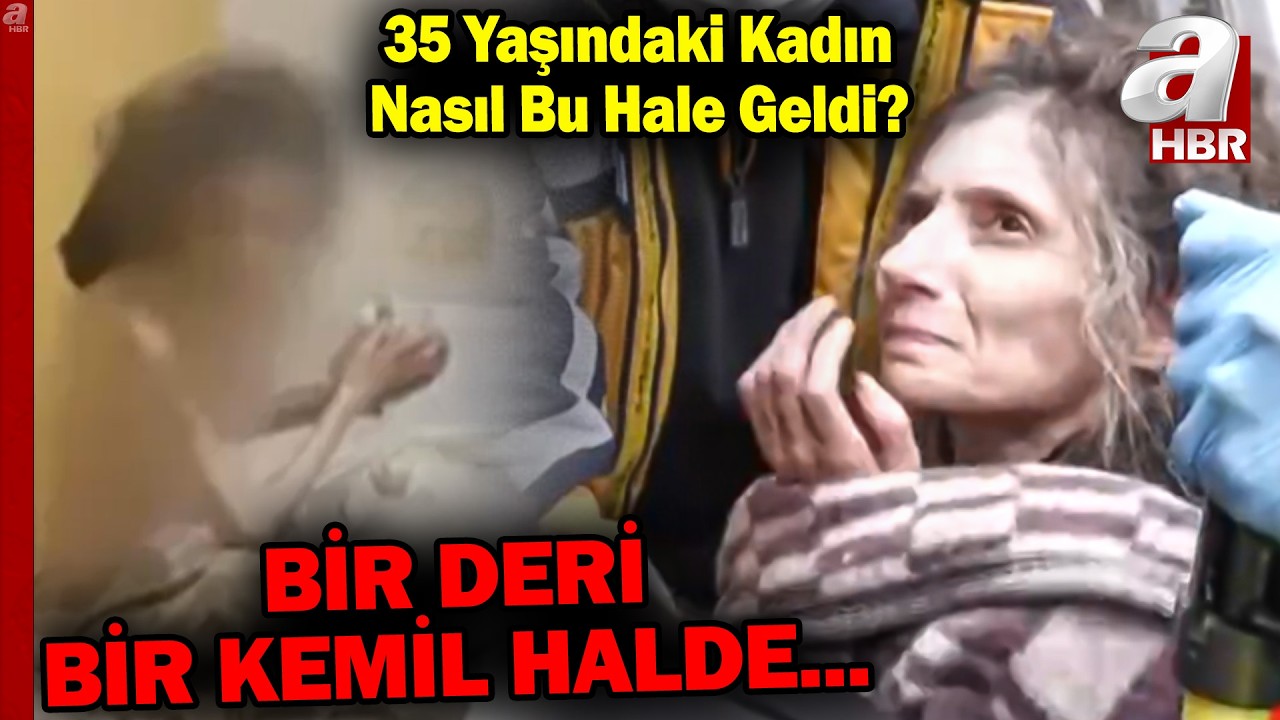 Bulunduğunda Bir Deri Bir Kemik Haldeydi... 35 Yaşındaki Kadın Nasıl Bu Hale Geldi? | A Haber