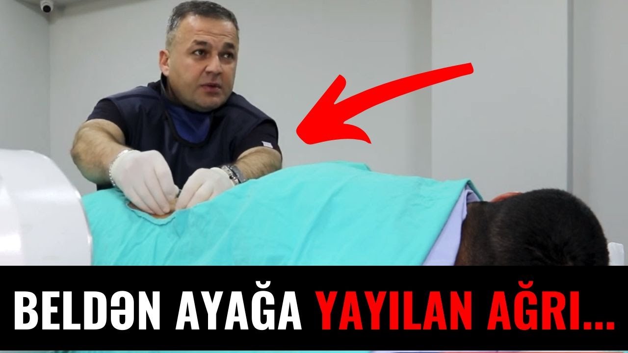 Beldən Ayağın Altına Qədər Yayılan Ağrını Görün Həkim Necə Yox Etdi...