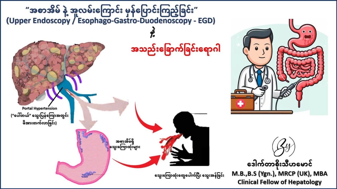 အသည်းခြောက်တဲ့လူနာတွေ ဘာလို့ “အစာအိမ် နဲ့ အူလမ်းကြောင်း မှန်ပြောင်း” ကြည့်ဖို့ လိုအပ်တာလဲ???