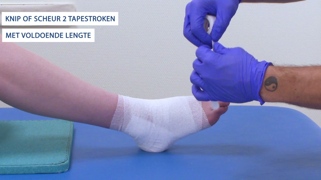 Drukverband spaakverwonding oppervlakkig