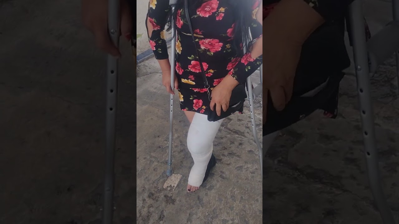 Clip 66 exclusive video my wife in LONG LEG CAST