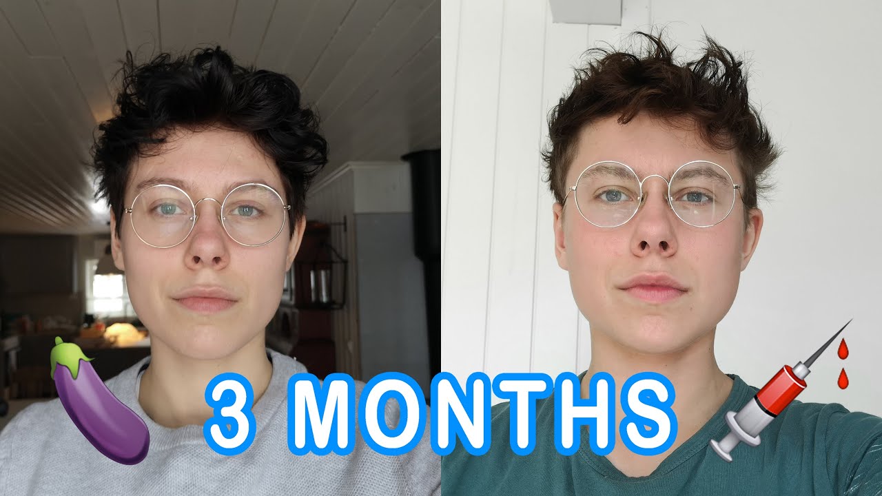 3 Months on Testosterone Update - TMI!!! | FTM Trans Guy