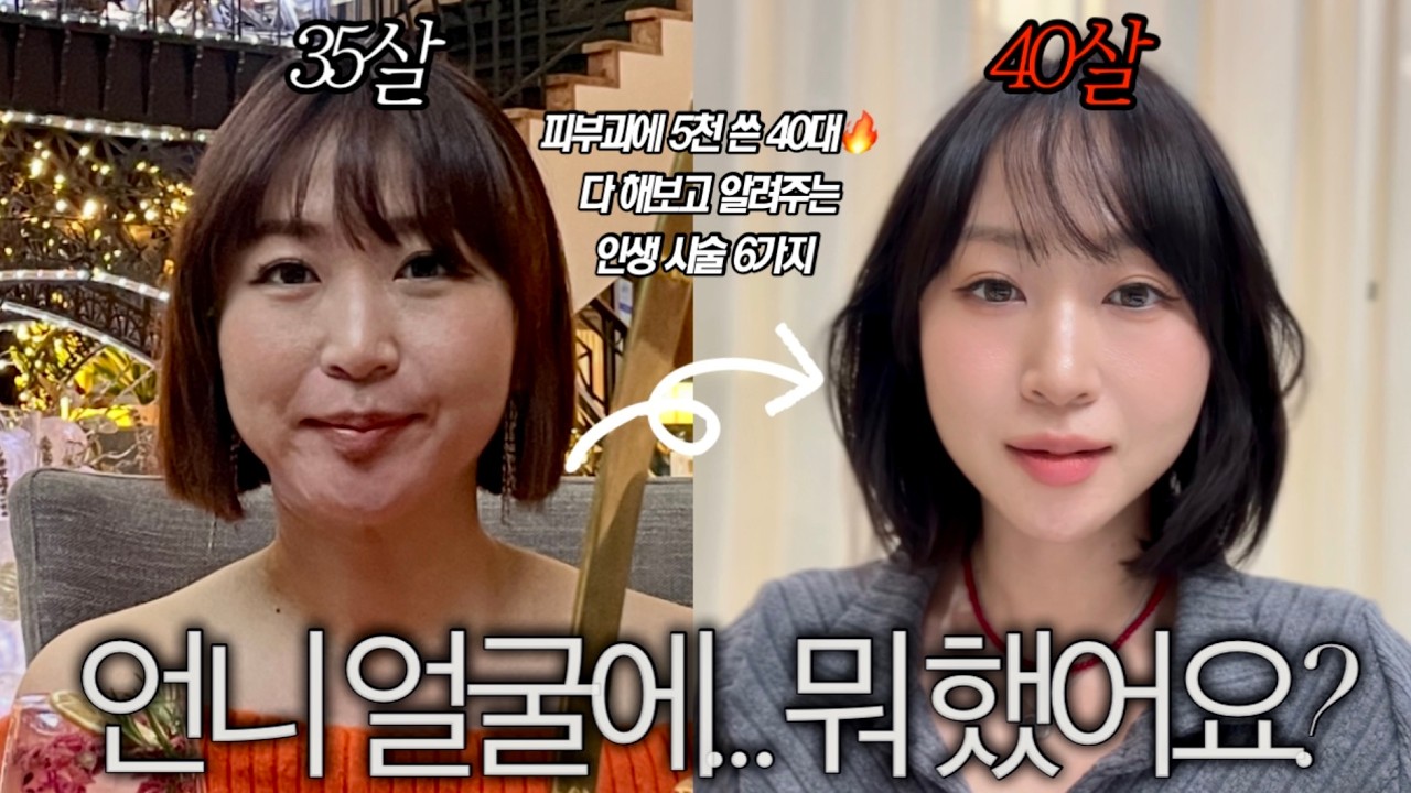얼굴에 뭐 했냐고요? 피부과에 5천 쓰고 진짜 효과 본 시술 6가지🔥 다 해본 40대가 다시 30대로 돌아가도 무조건 하는 인생 시술 추천✨
