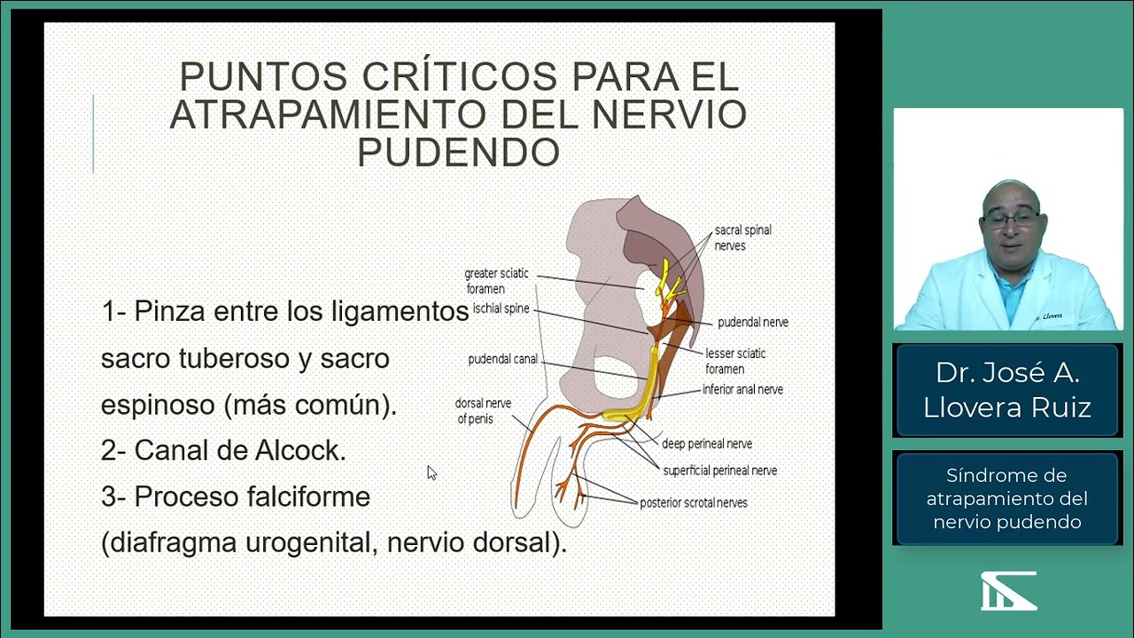 Síndrome del atrapamiento del nervio pudeno