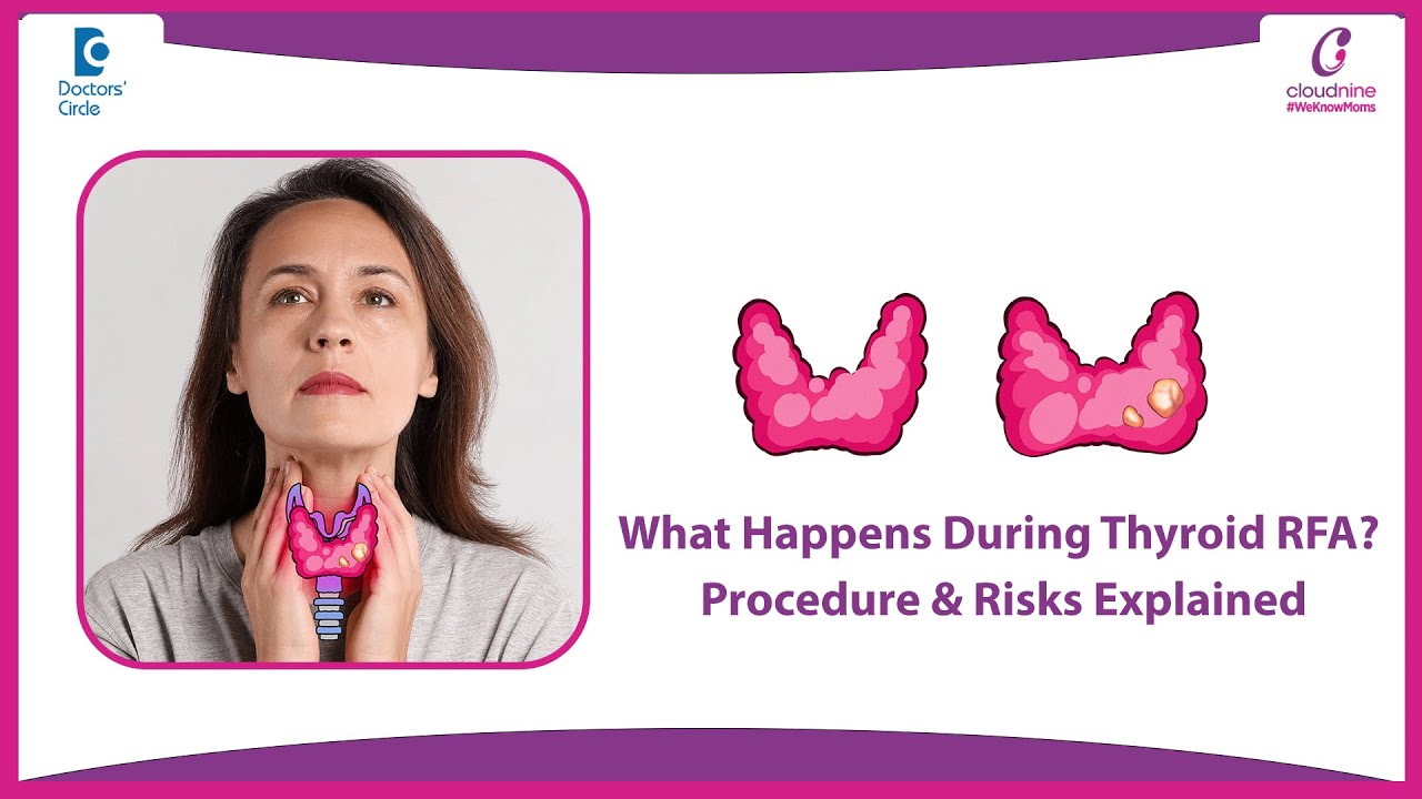 Thyroid Lump Treatment Without Surgery - Dr. Junaid Ahmed Jamadar | Doctors' Circle