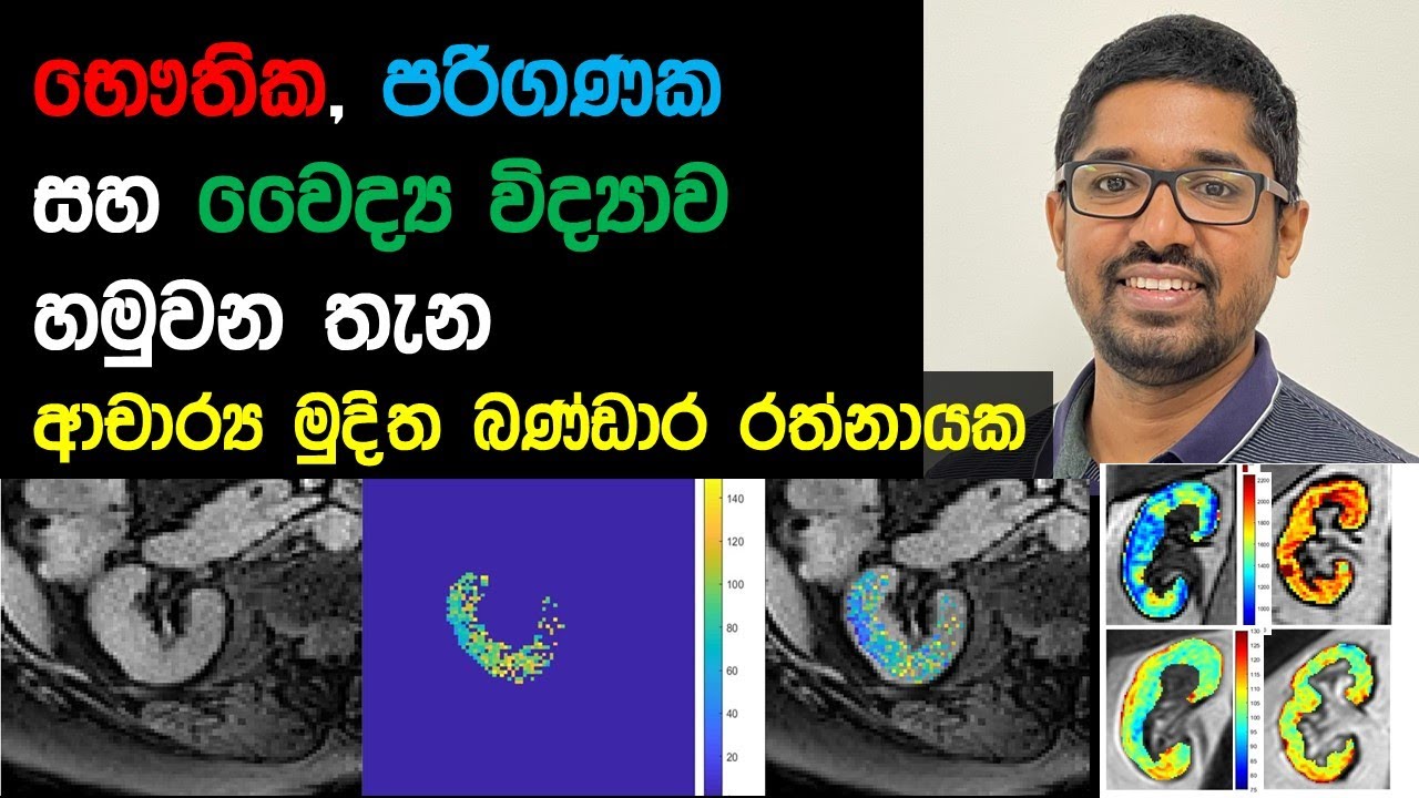 භෞතික, පරිගණක, වෛද්‍ය විද්‍යාව හමුවන තැන Bio-Medical Imaging Physics Dr. Muditha Bandara Rathnayaka