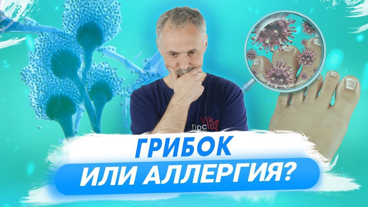 Грибок ногтей и кожи: лечение и профилактика / Доктор Виктор