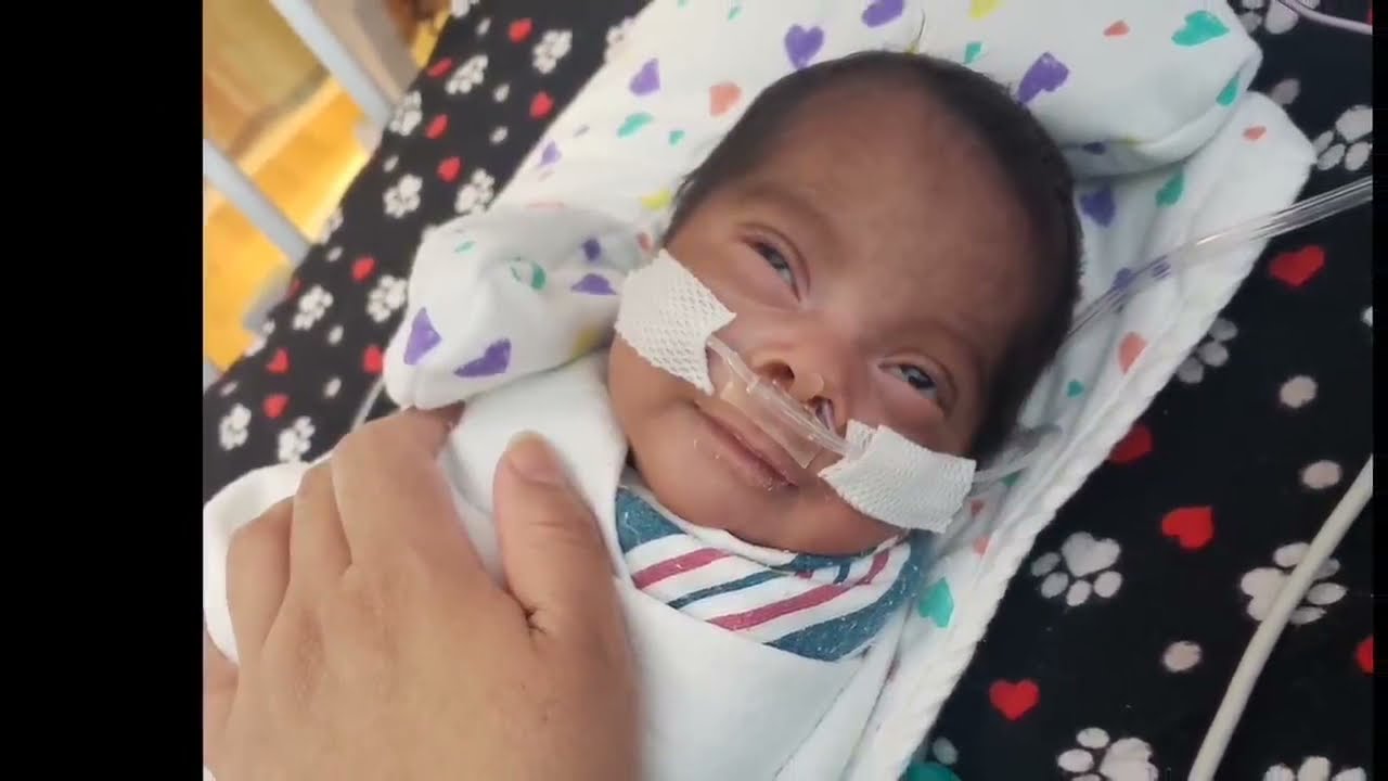 Milagro de vida/Beb&eacute; prematuro de 27 semanas de Gestaci&oacute;n