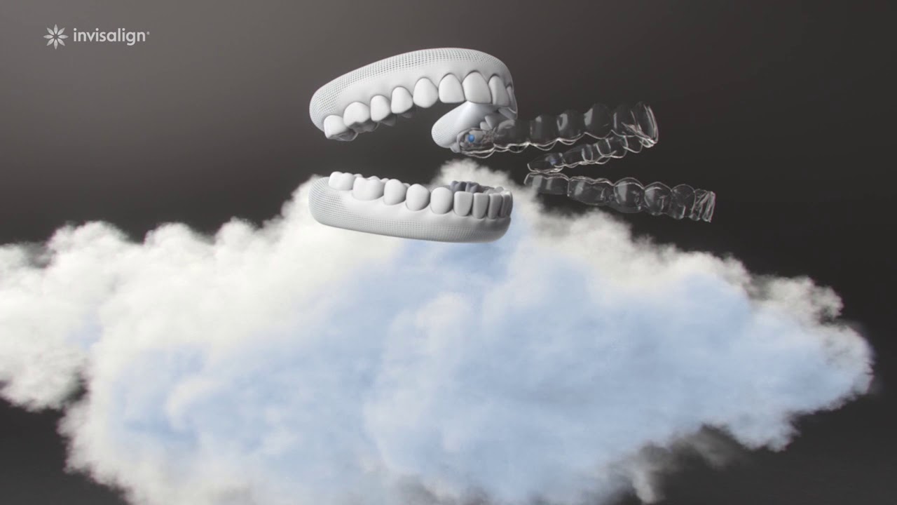 How Invisalign Works | Northenden House Orthodontics