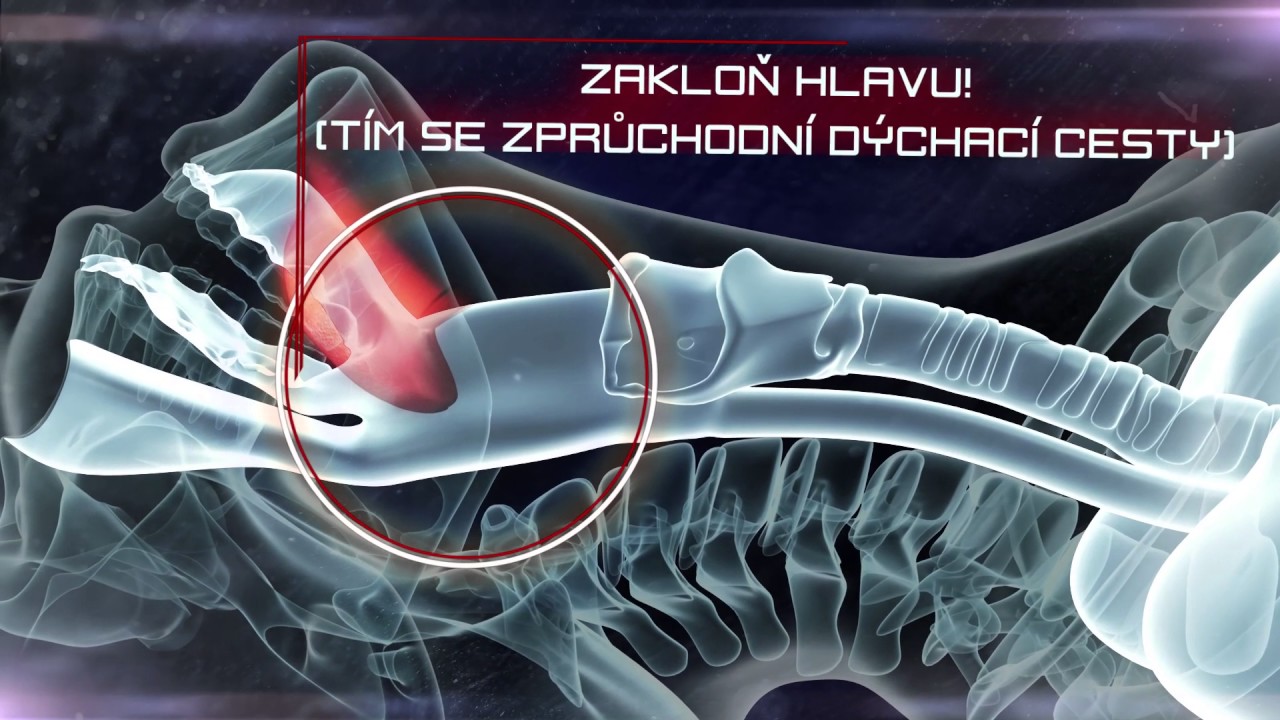 Ty to zvládneš.cz - KŘEČE, EPILEPSIE
