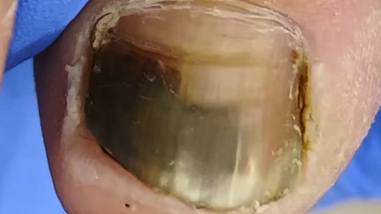 ¡Uñas de los pies sucias! Perfectamente recortadas.