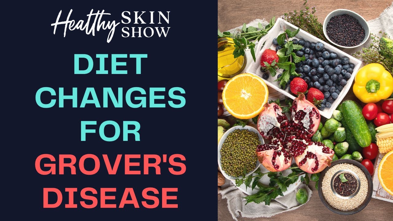 GROVER'S DISEASE: Lifestyle + Diet Shifts | Dr. Raja Sivamani