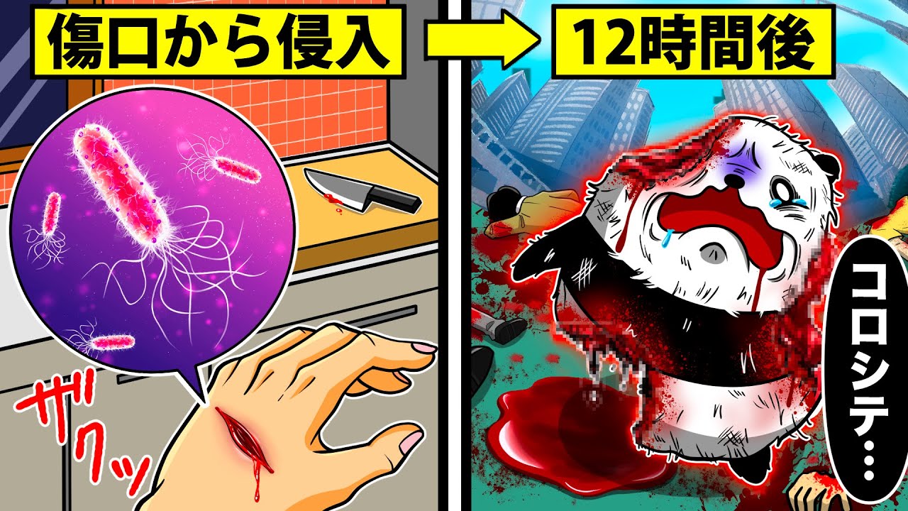 【恐怖】人食いバクテリアに感染するとどうなるのか？【アニメ】