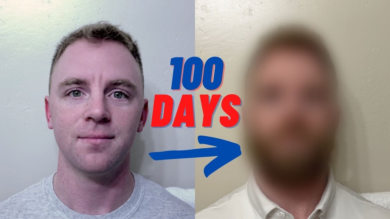 Three Month Beard Growth Time-Lapse