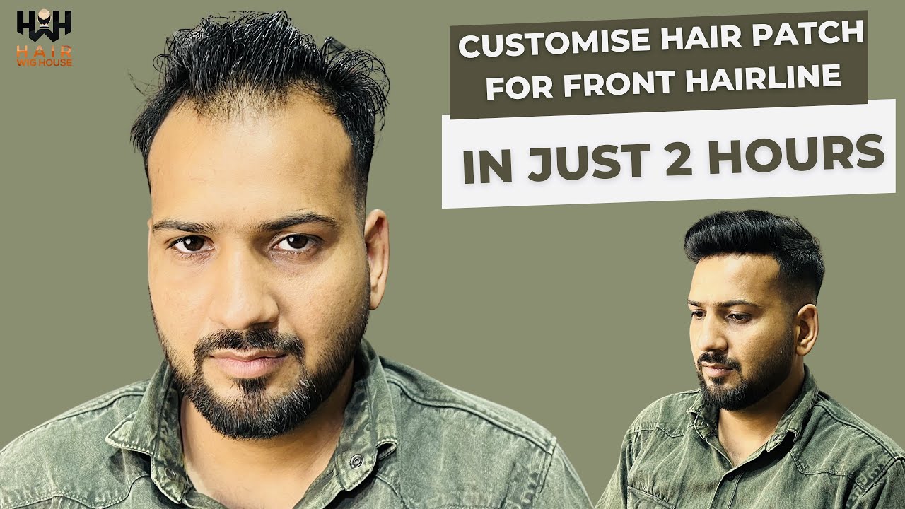 Hairline Receding Solution | Customised Hairline Patch / हेयर लाइन पैच For Front | Hair wig house