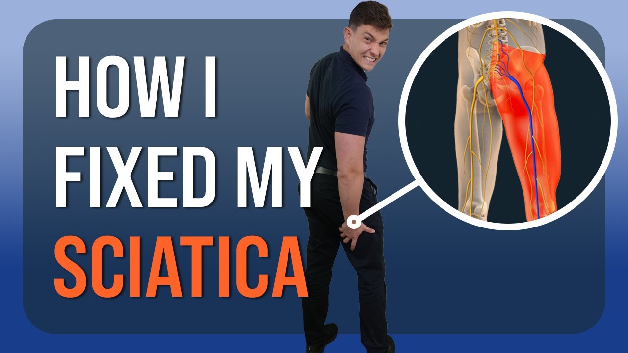 How I Healed My Sciatica: Personal Recovery Story