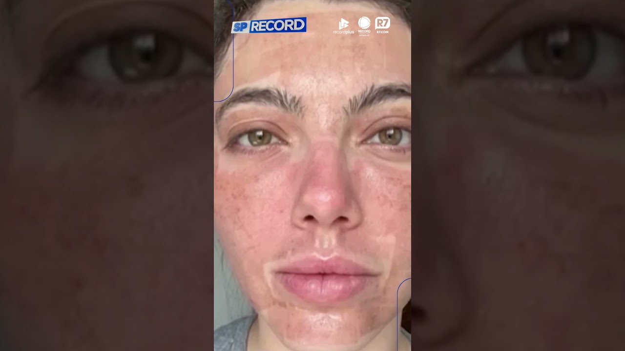 A busca por uma pele perfeita pode esconder riscos