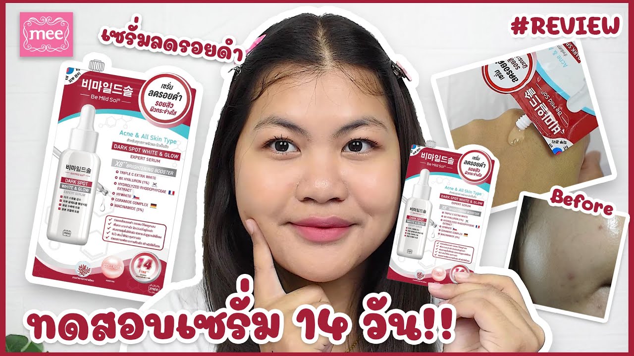 รีวิว#MEE DARK SPOT WHITE & GLOW EXPERT SERUM เซรั่มลดรอยดำ | ของมันต้องรีวิว ep.119 | the peak