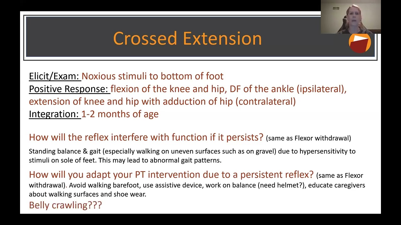 Dr. Suzanne Giuffre presents on Pediatric Primitive reflexes.
