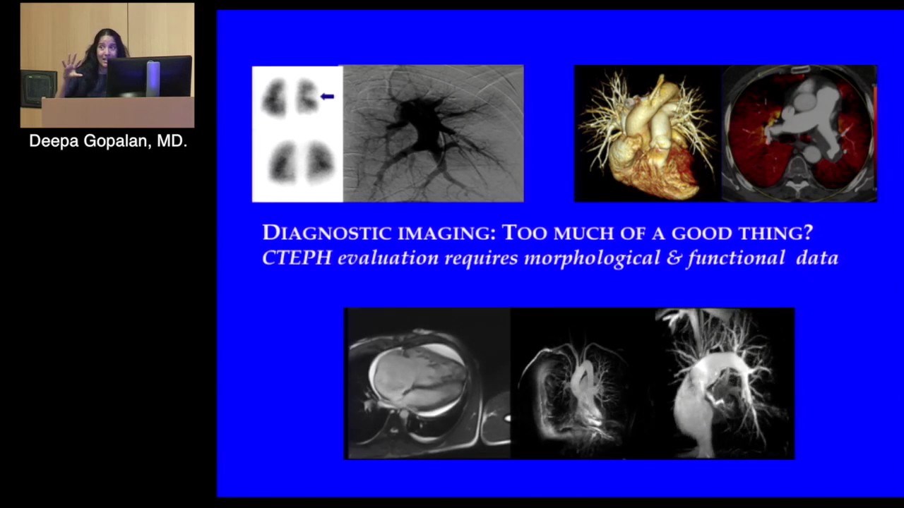Imaging: Making the Diagnosis of CTEPH 