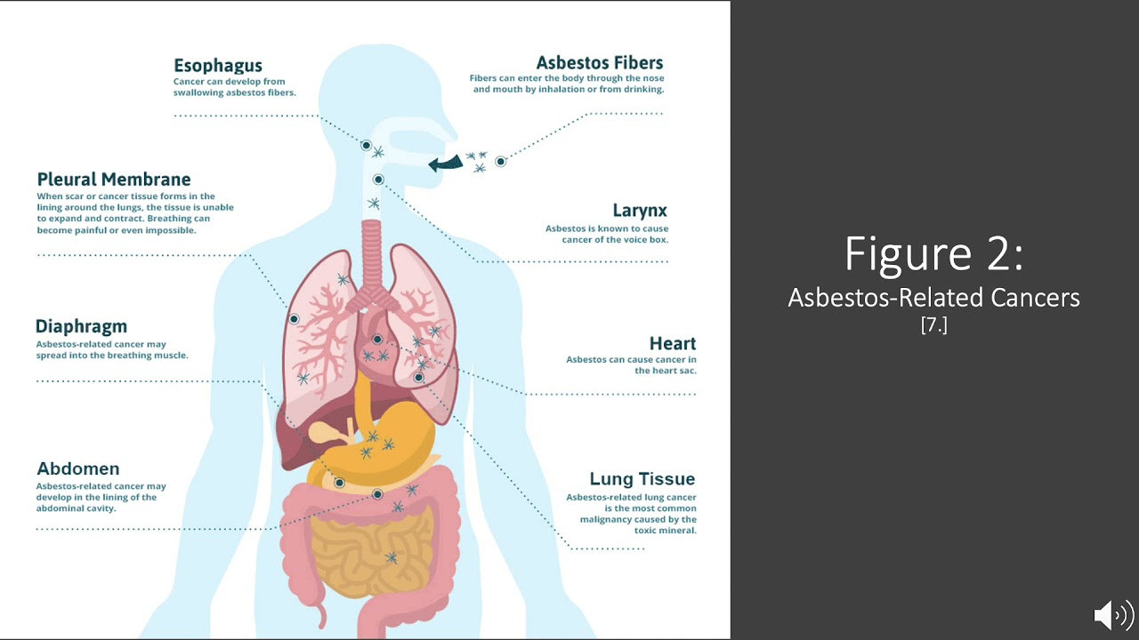 Libby, Montana - Asbestos Hazard