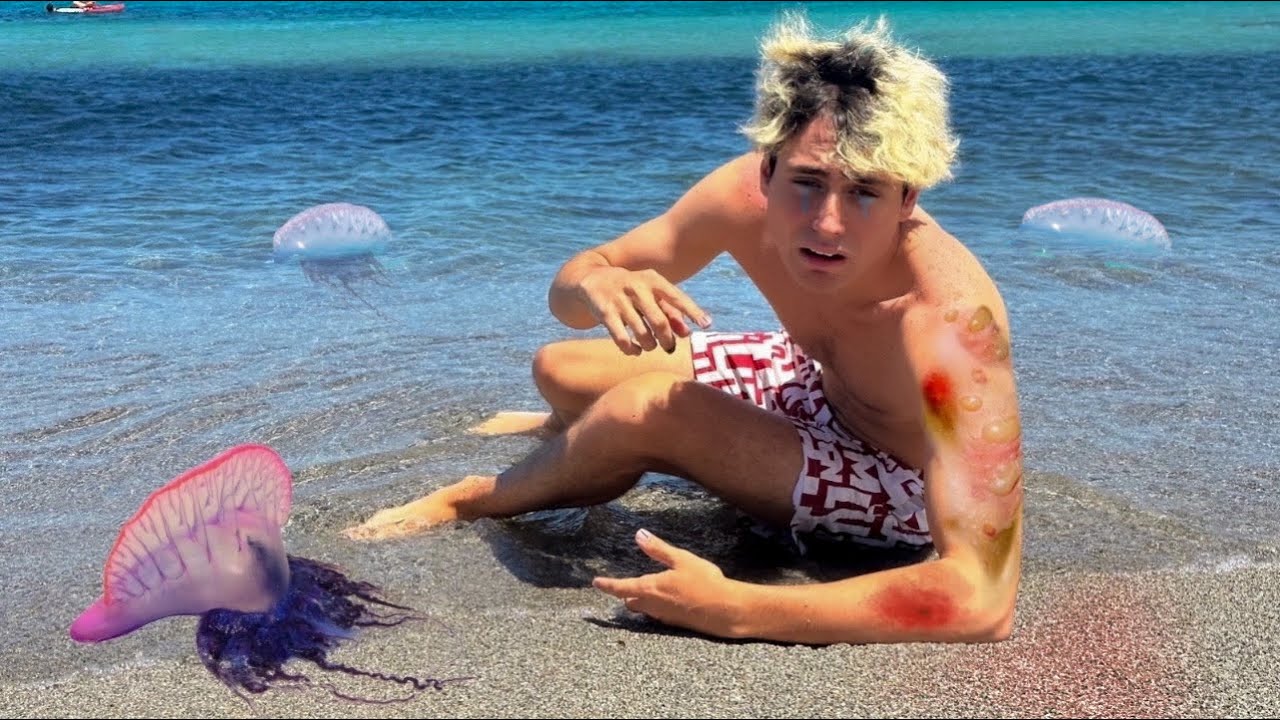 ANTO È STATO PUNTO DA UNA MEDUSA GIGANTE AL MARE…😱😭
