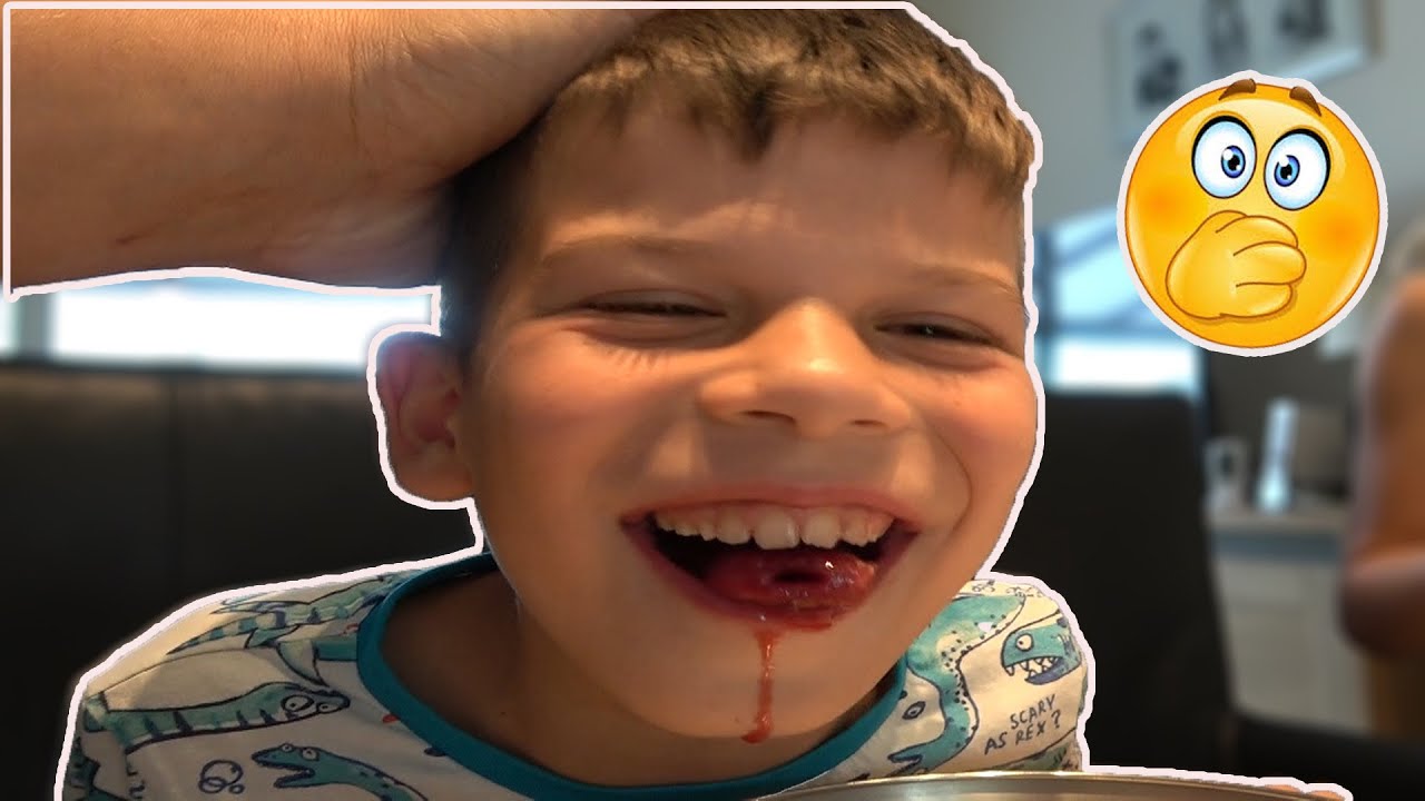 BLOED JAYSON NU ?? KOETLIFE VLOG