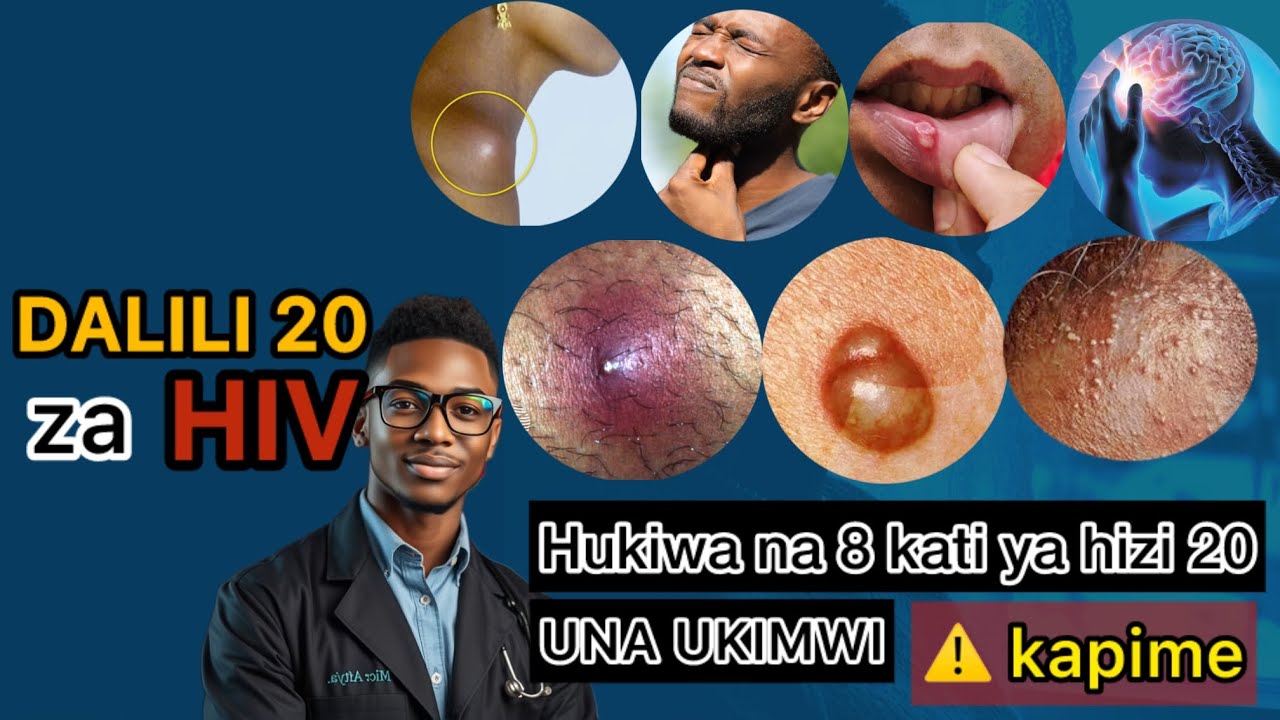 Jipime UKIMWI Kwa Hizi Dalili 20: Dalili 20 za UKIMWI za mwanzoni/ wiki ya 2-4