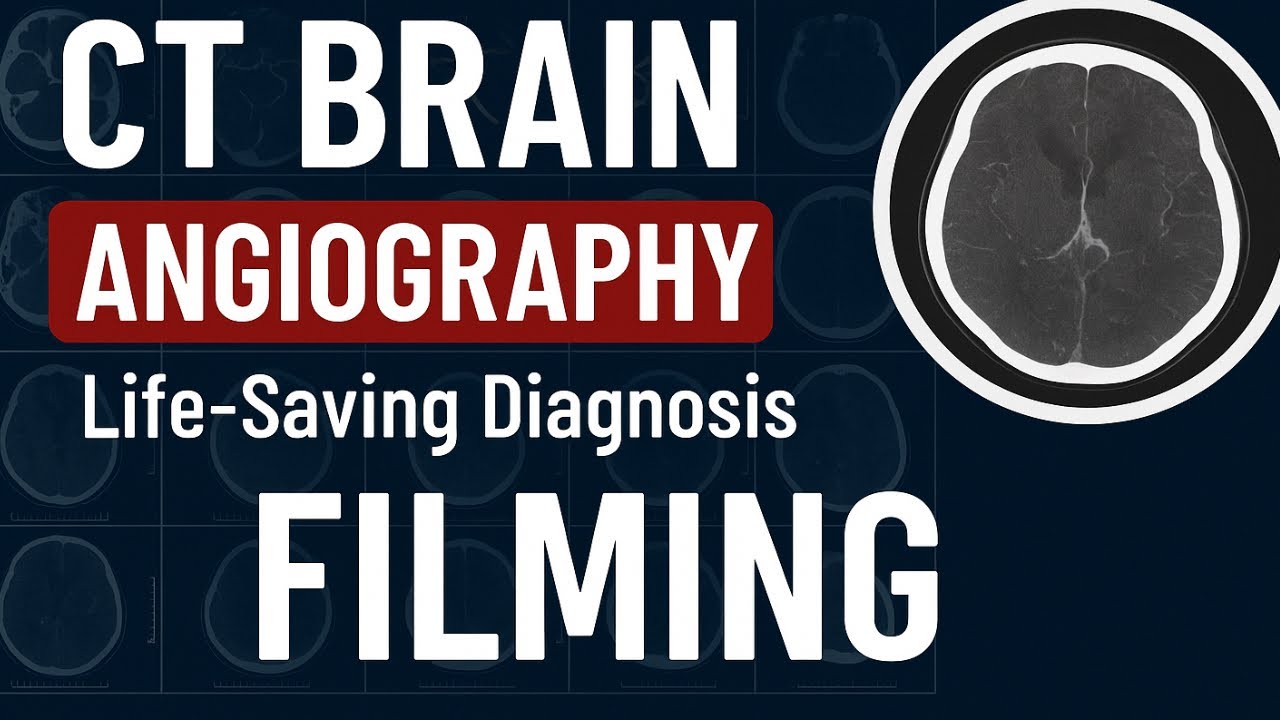 CT Brain Angiography Filming | Step-by-Step Procedure on GE CT Scanner