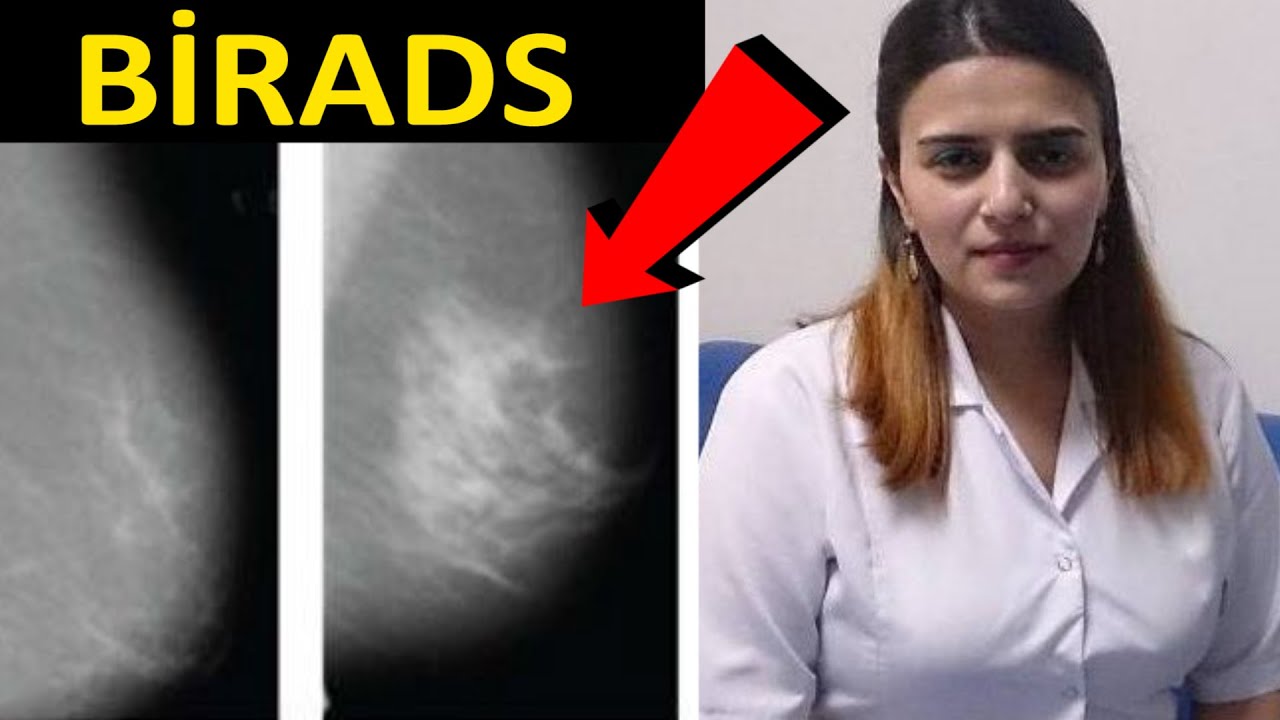Həkimlərin yazdığı sözə DİQQƏT edin! - BİRADS nədir?