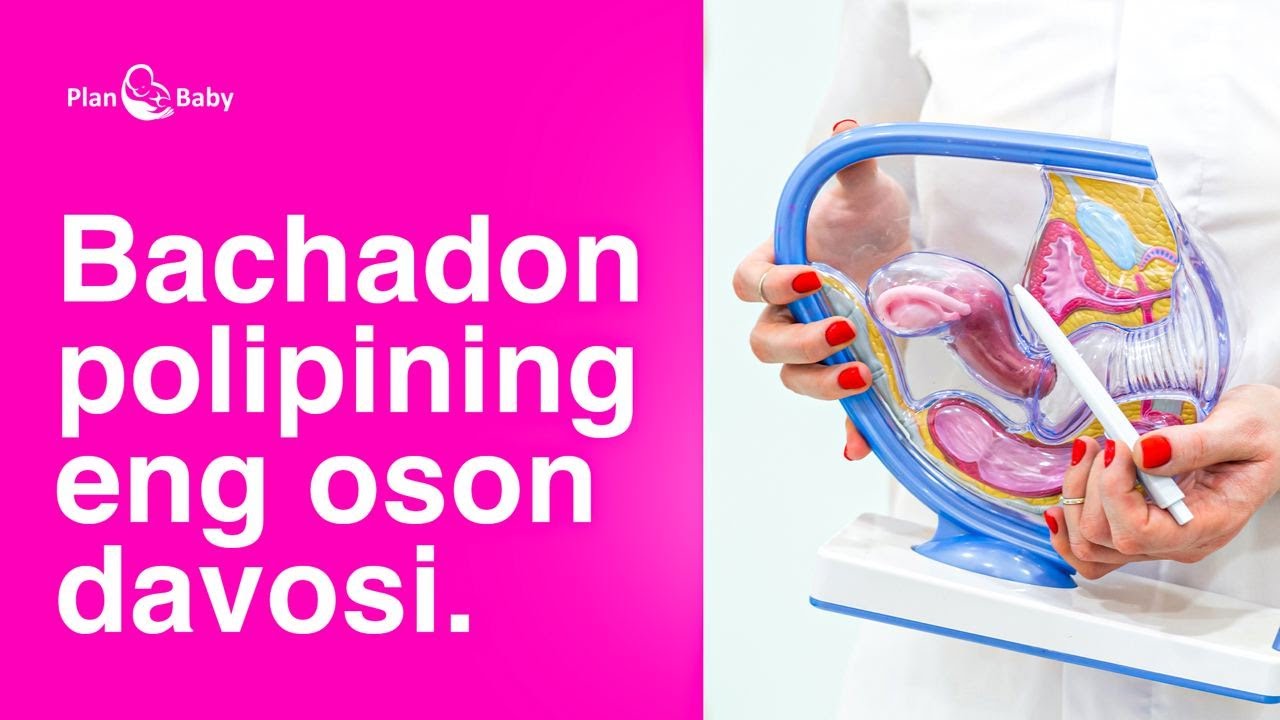 Biz buni DAVOLAY OLAMIZ - #Bachadon #polipin #davo #Klinika #Clinic