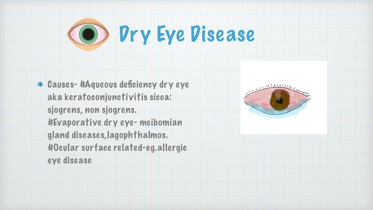 Let's learn Lacrimal Apparatus