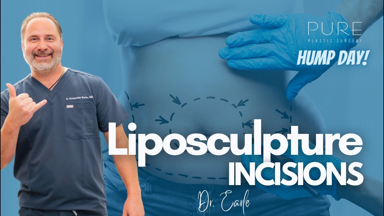 Hump Day Live with Dr. Alex Earle: Unveiling Liposculpture Incisions! 🎥✂️