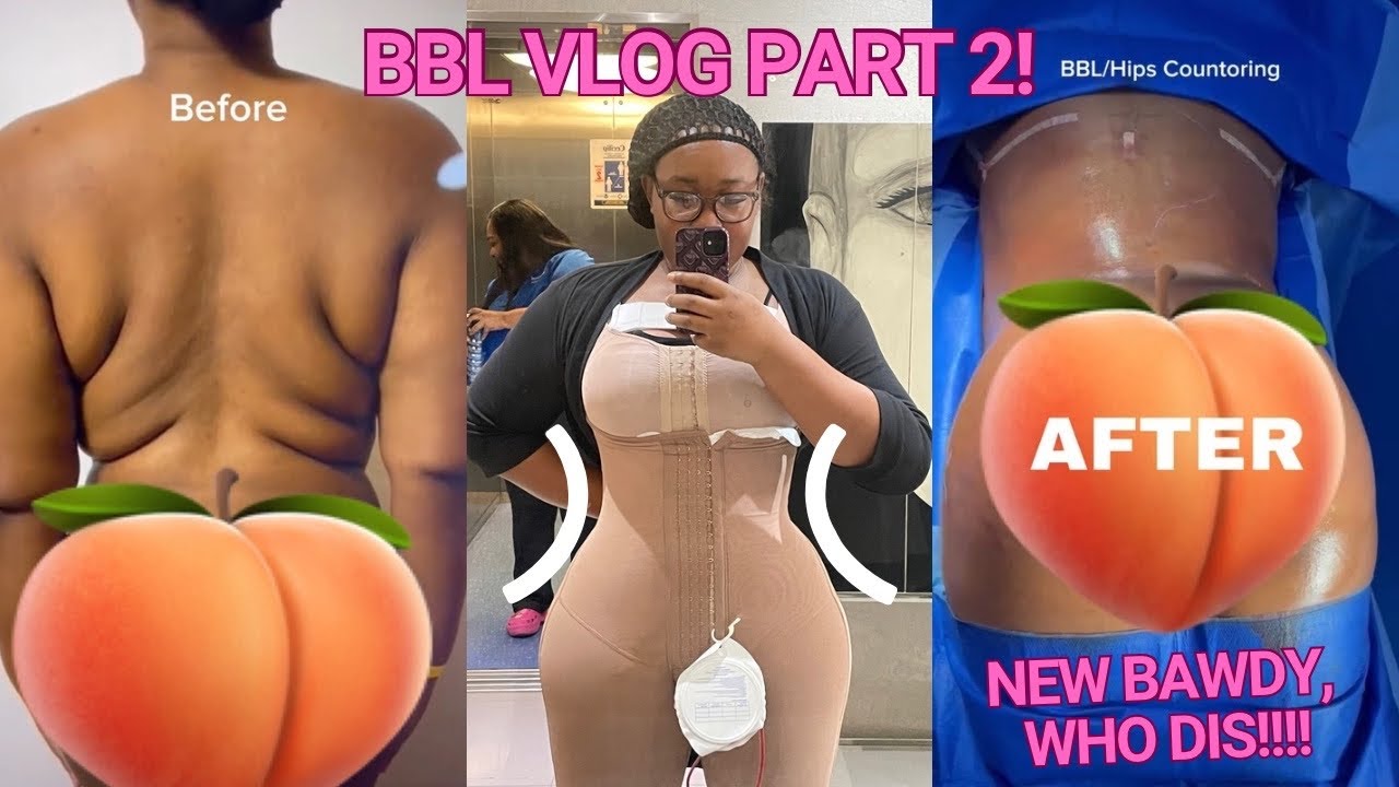 I got a BBL in Dominican Republic! Part 2 *RAW & GRAPHIC*