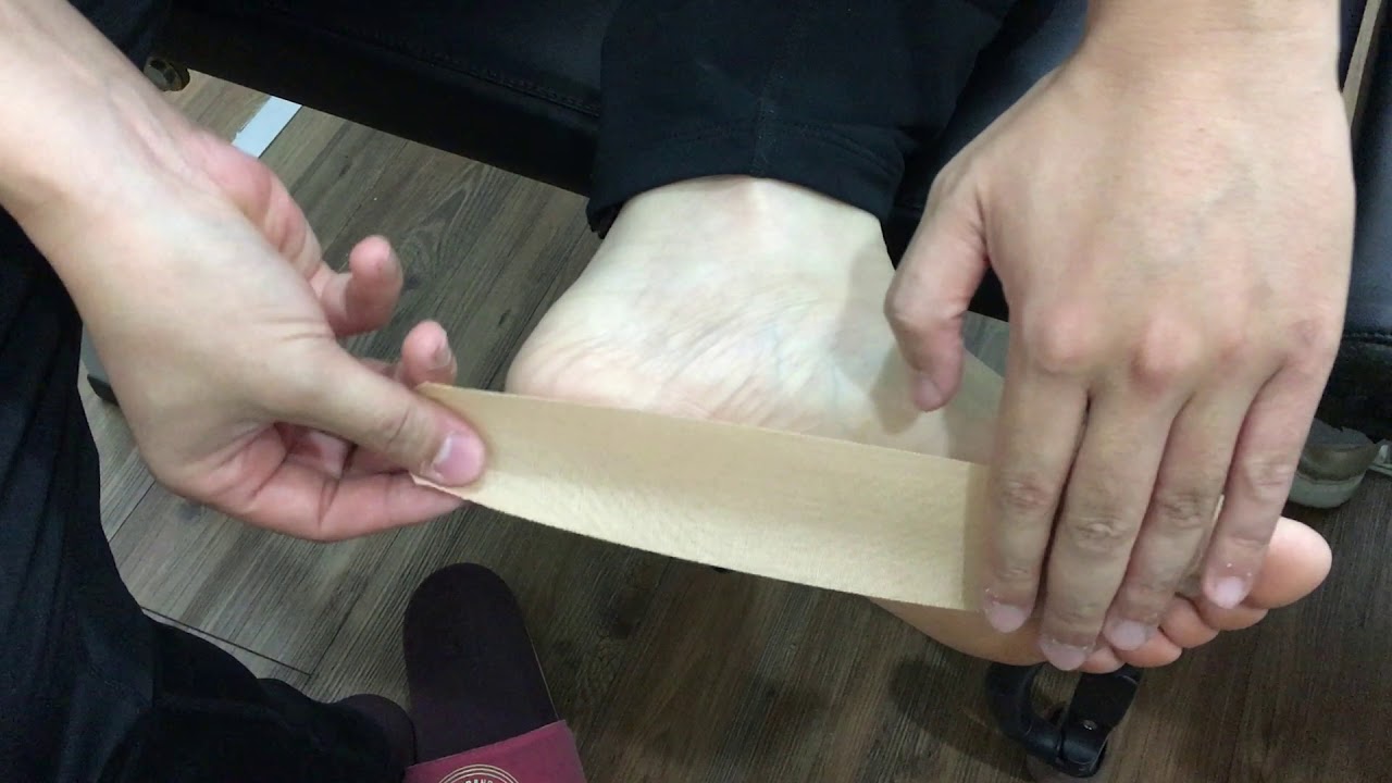 족저근막염 아치 살려주는 키네시오 테이핑