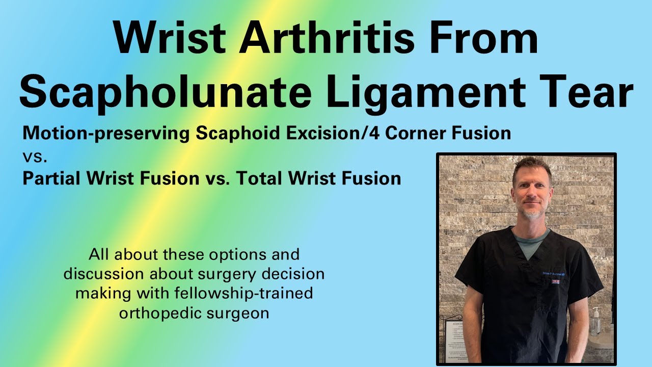 Hand Surgeon Discusses Wrist Arthritis Surgery