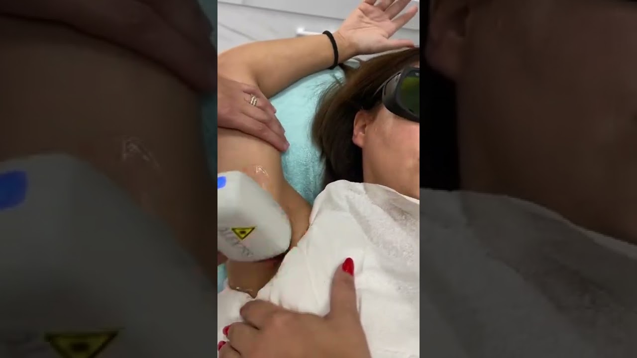 Alma Soprano Titanium epilacija, ne boli, poslu&scaron;aj